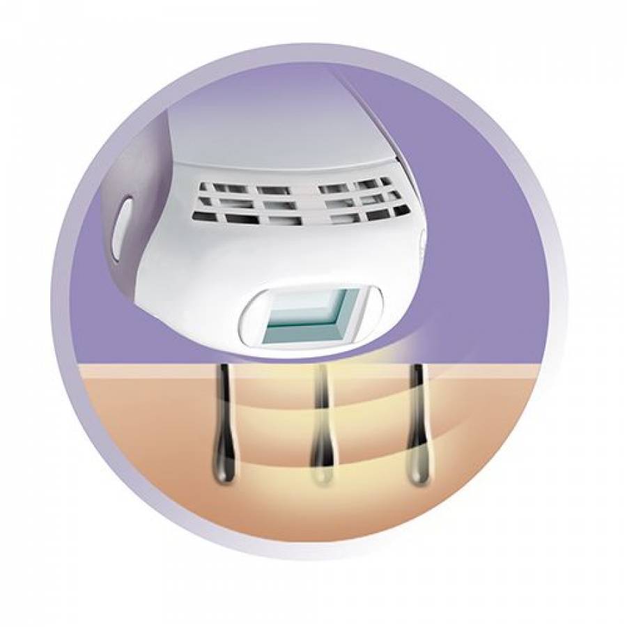 Epilator Electric Cu Lumina Intens Pulsata Remington I-light Pro , Bec Infinity , Tehnologie Propulse, 5 Setari De Putere , Senzor De Piele , Alb/mov